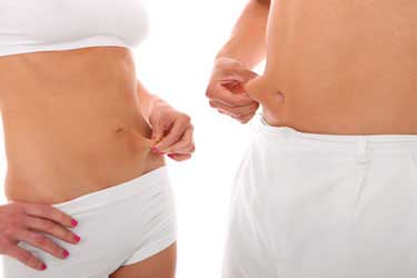 Abdominoplastik Düren